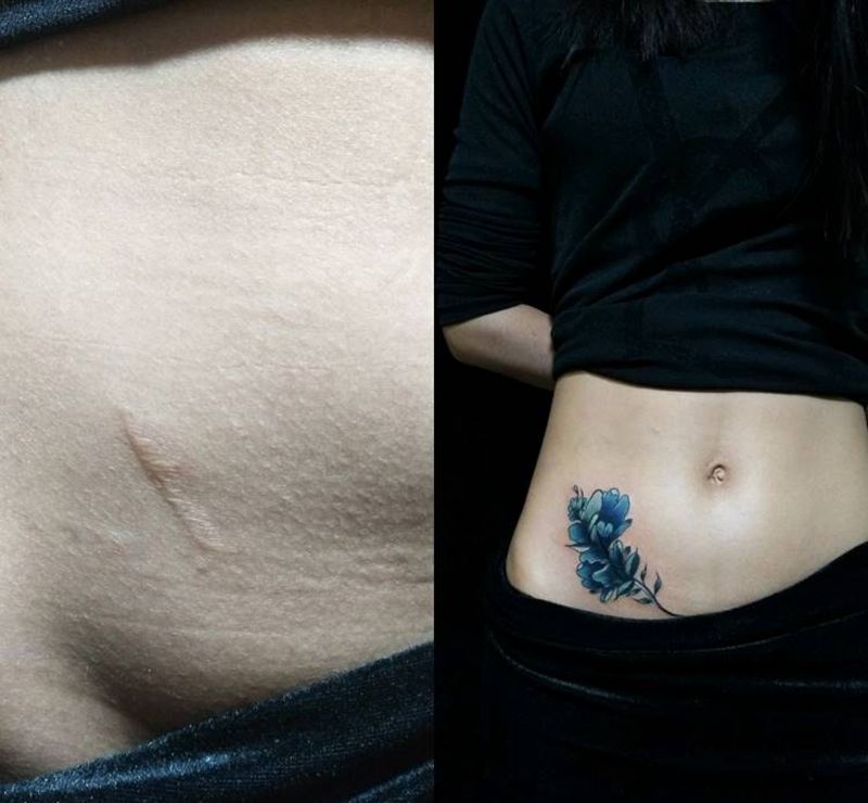 疤痕遮盖纹身图片