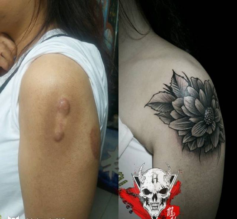 疤痕美化纹身图片