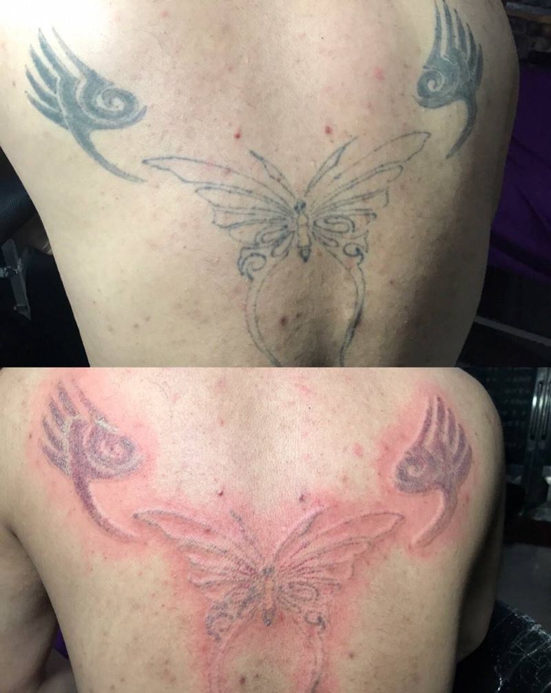 洗纹身对比纹身图片