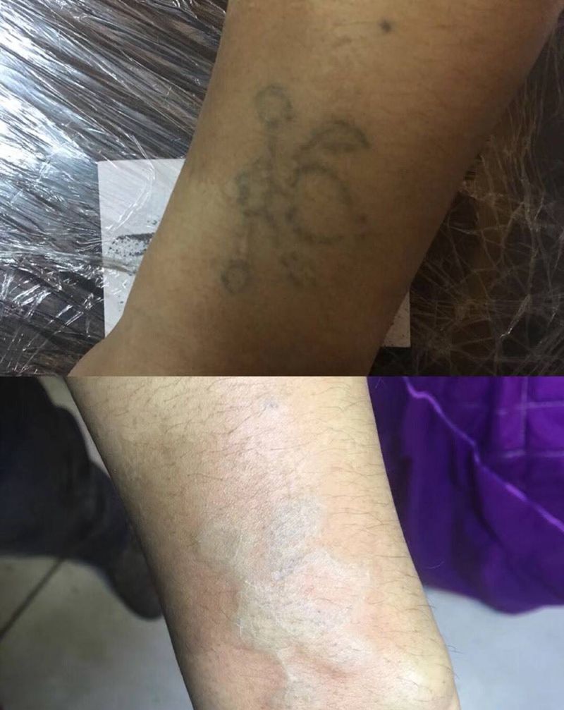 清洗纹身纹身图片