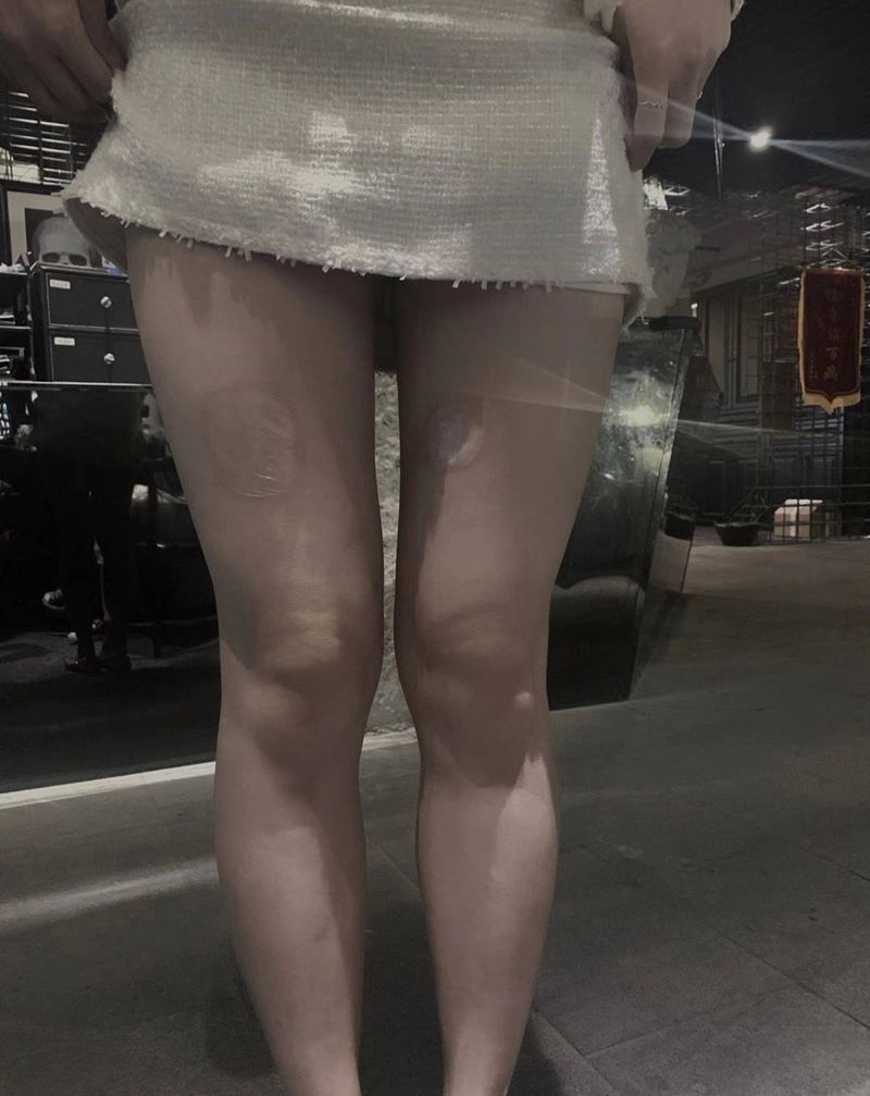 素花遮盖大腿疤痕纹身图片_腿部点刺纹身图案