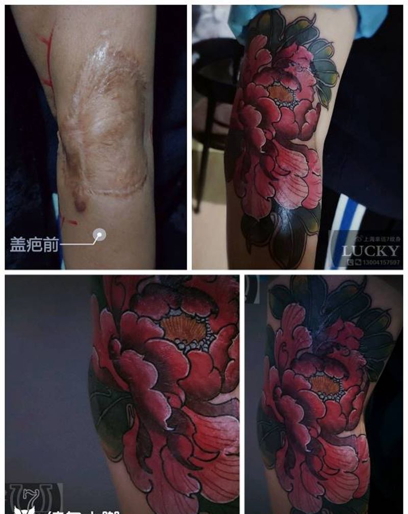 盖疤|牡丹|幸运7纹身纹身图片_手臂New School盖疤纹身图案