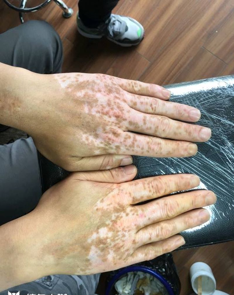 皮肤修复色纹身图片_手臂手部皮肤色皮肤修复纹身图案