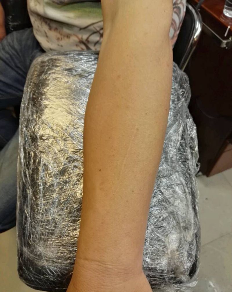 疤痕遮盖纹身图片_手臂传统图腾原创成品纹身图案