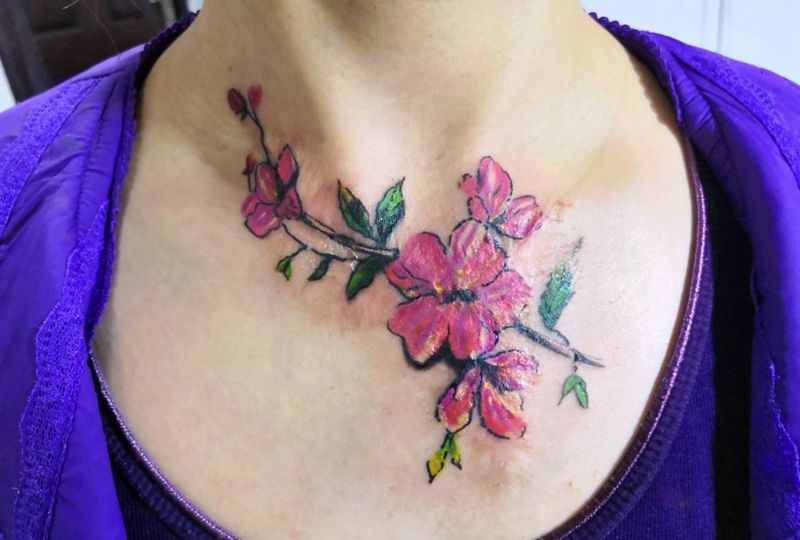 客人想找个小图适当遮盖疤痕