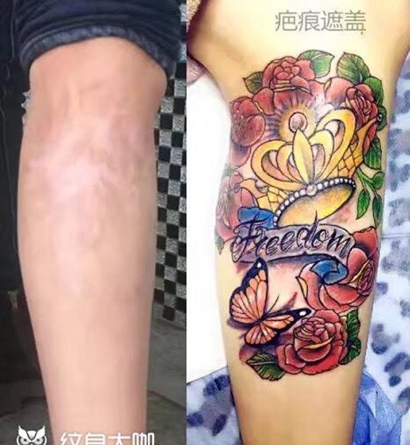 本店作品疤痕遮盖纹身图片