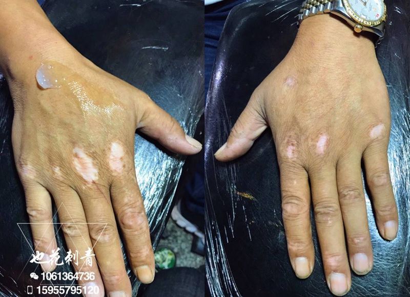 白斑遮盖纹身图片_成品手部传统写实静物原创人物纹身图案