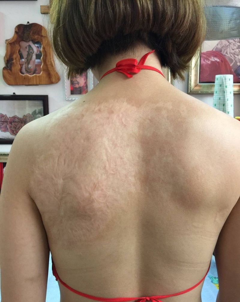 盖疤痕纹身图片