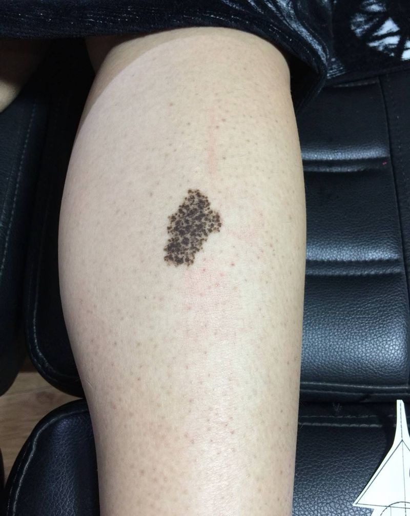 遮盖胎记纹身图片