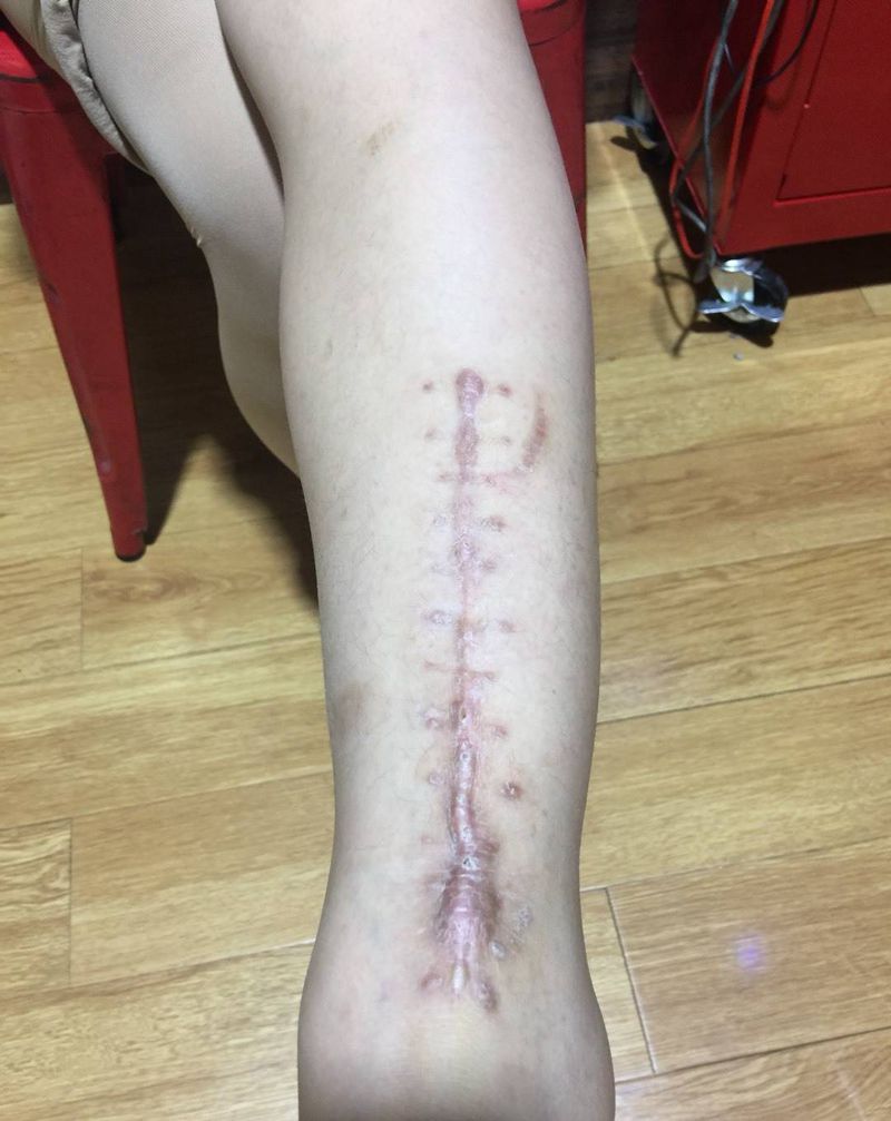 遮盖疤痕纹身图片