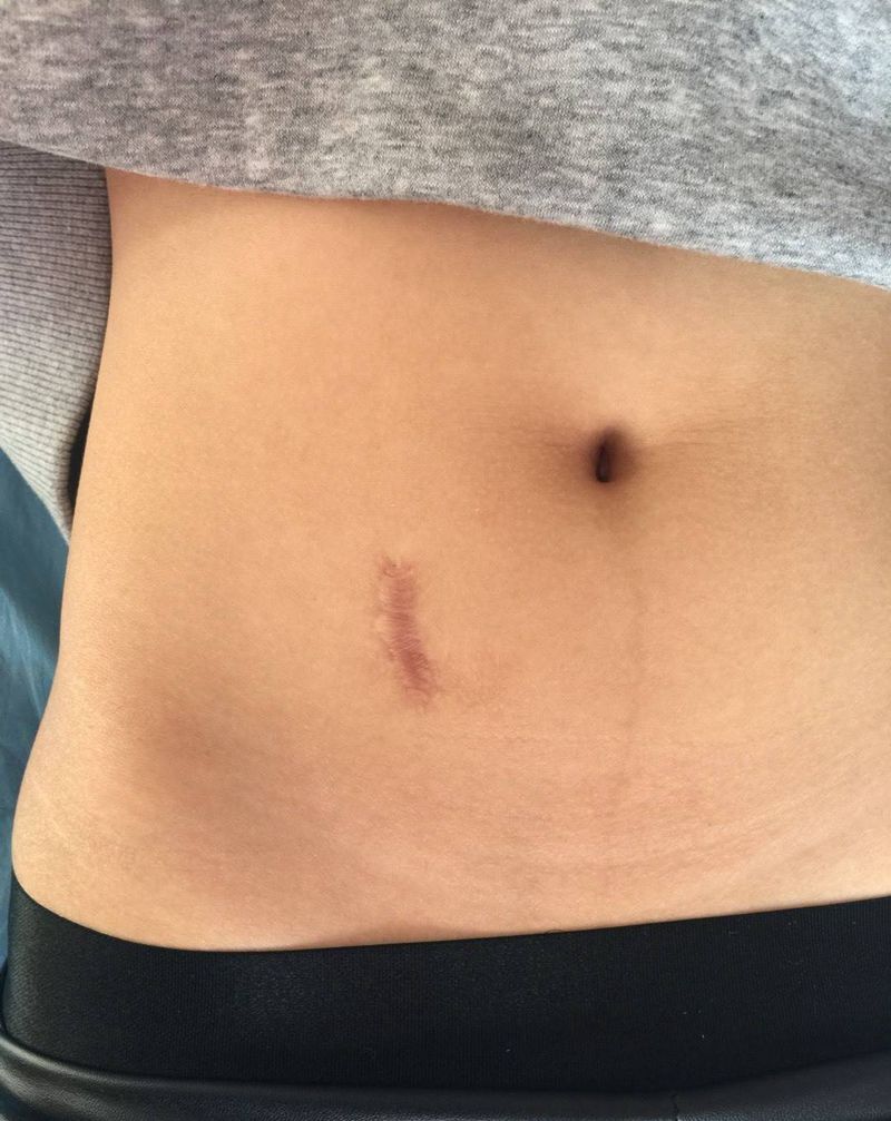 遮盖疤痕纹身图片