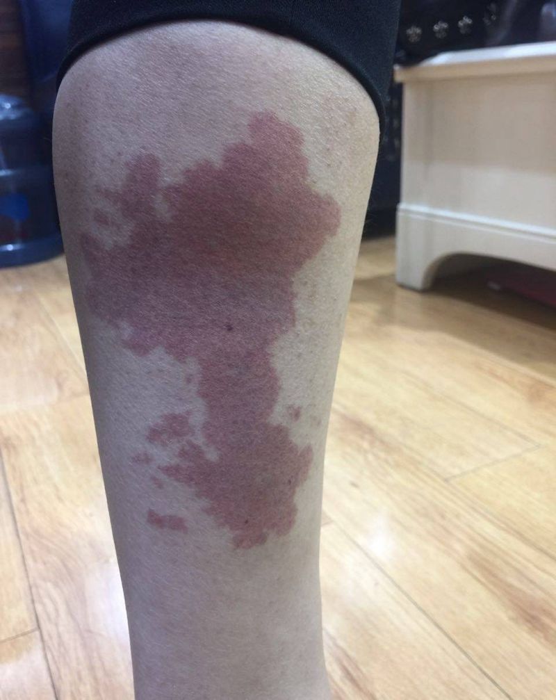 遮盖胎记纹身图片