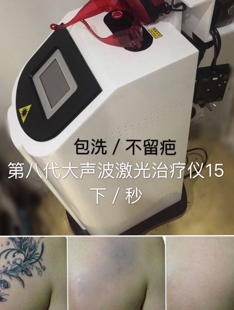 洗纹身包洗纹身图片