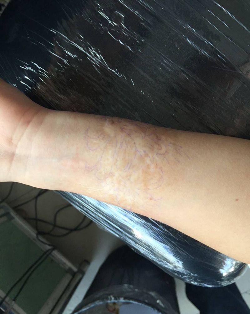 遮盖疤痕纹身图片