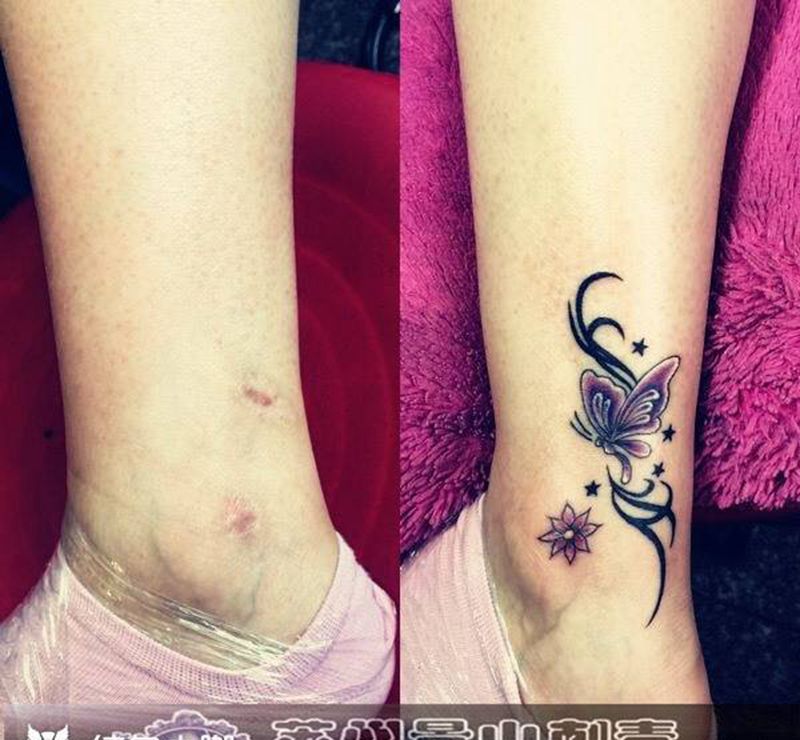 疤痕遮盖纹身图片