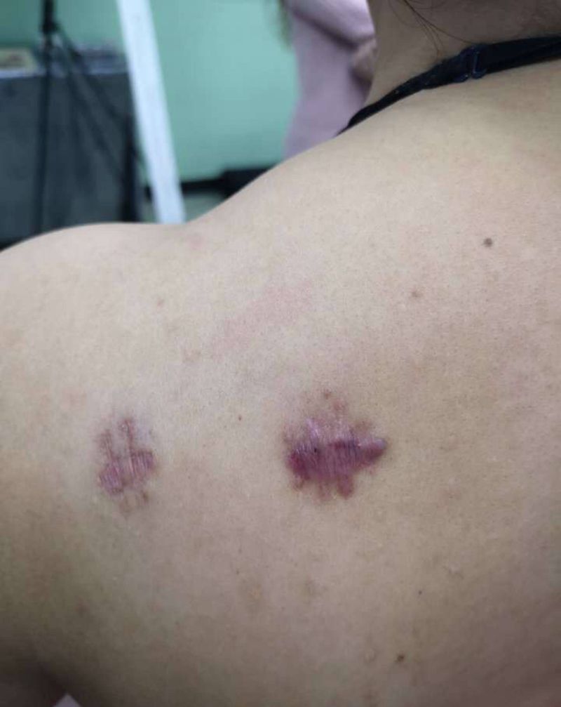 遮盖疤痕纹身图片