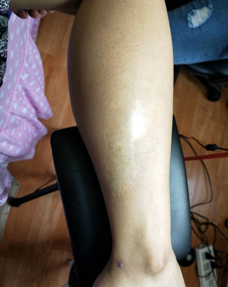 伤疤遮盖  兰花纹身图片