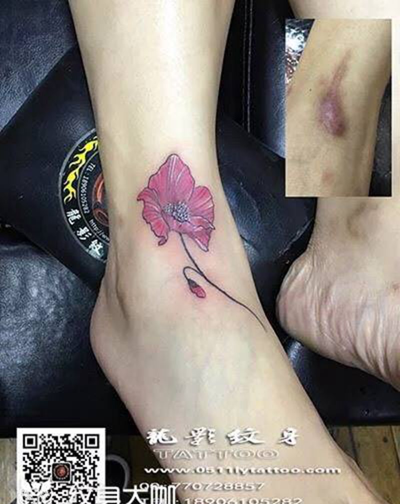 盖疤图纹身图片