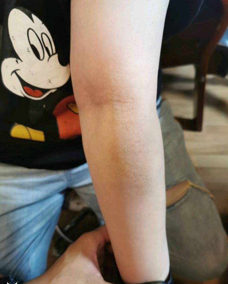 疤痕遮盖纹身图片_手臂纹身图案