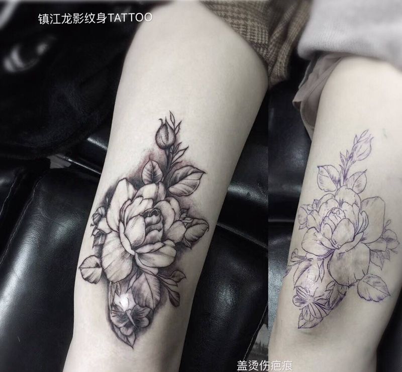 盖个烫伤疤痕纹身图片