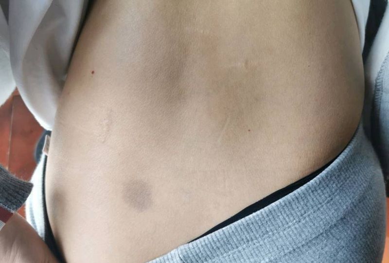 胎记遮盖纹身图片_腰部纹身图案