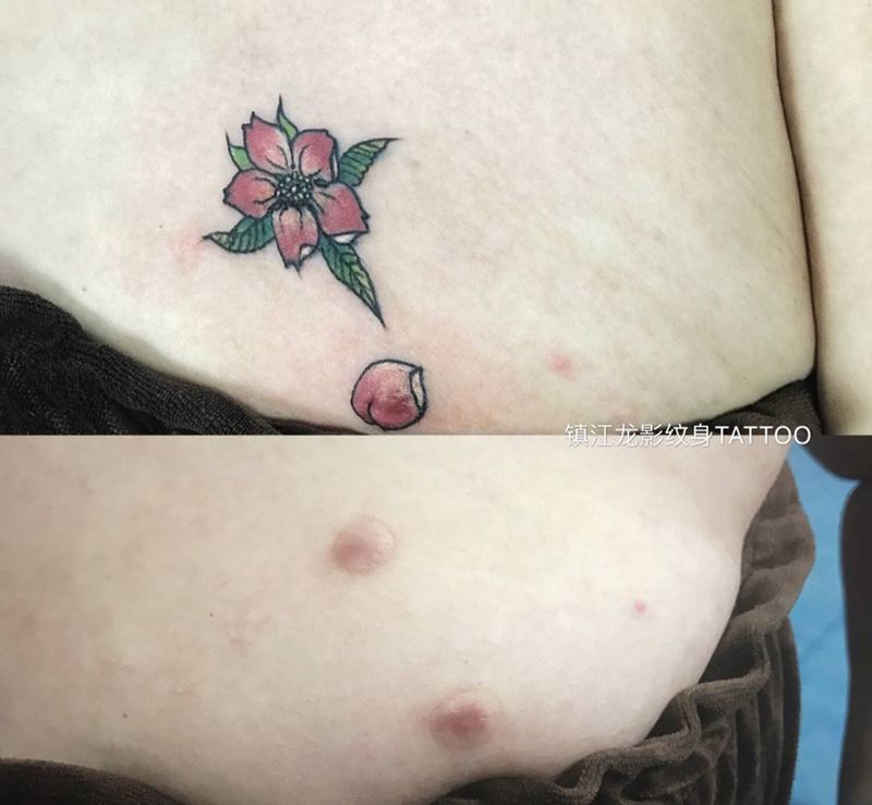 盖个疤纹身图片