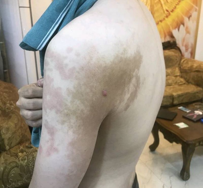 遮盖胎记纹身图片_背部卡通动漫纹身图案