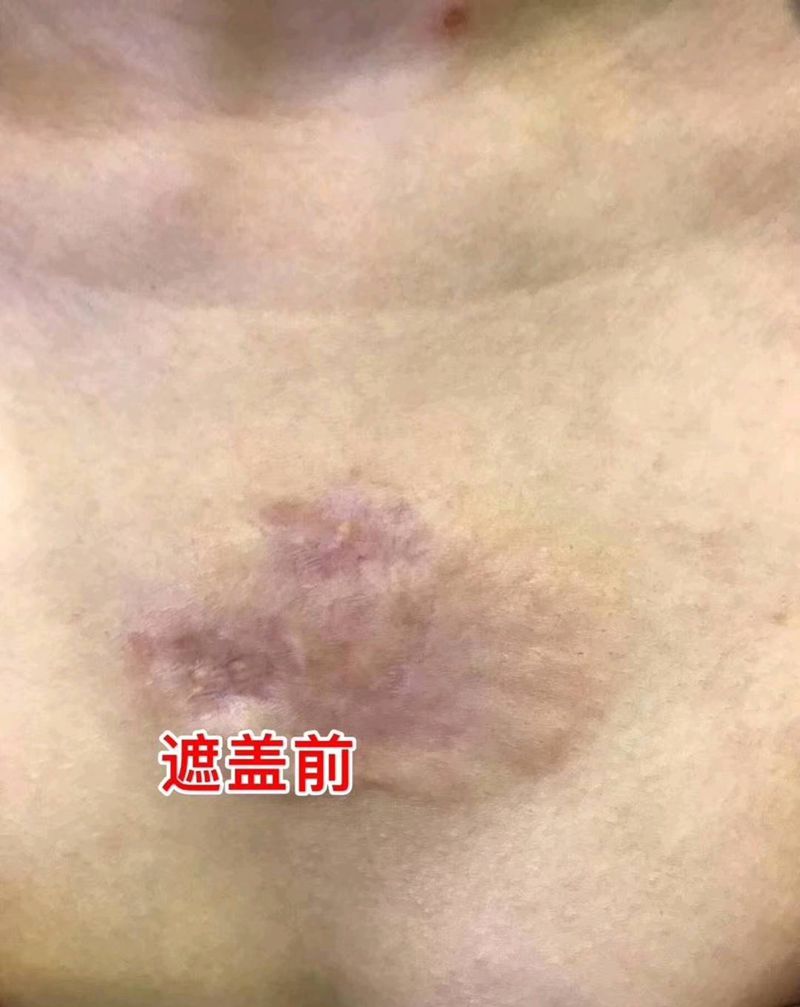 疤痕遮盖纹身图片_胸部水彩遮盖纹身图案