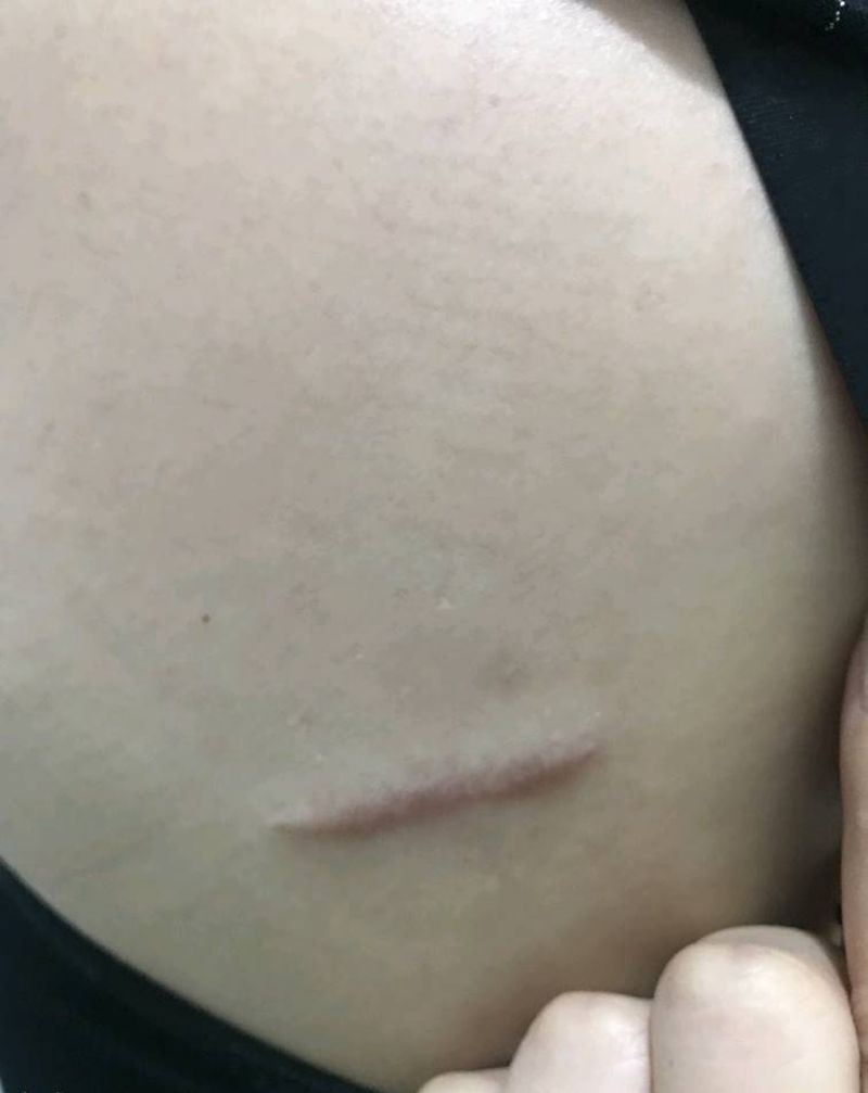 疤痕遮盖纹身图片_背部水彩水墨纹身图案