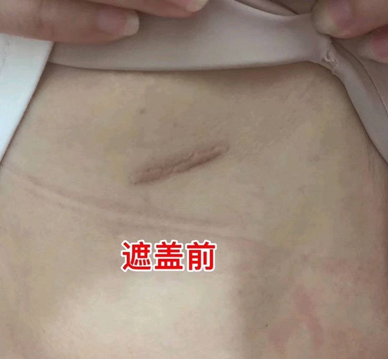 遮盖疤痕纹身图片_腰部点刺小清新纹身图案