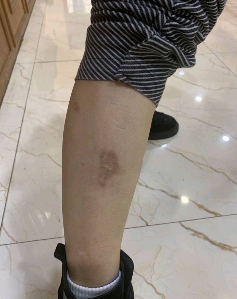 疤痕遮盖纹身图片_脚部水彩小清新纹身图案