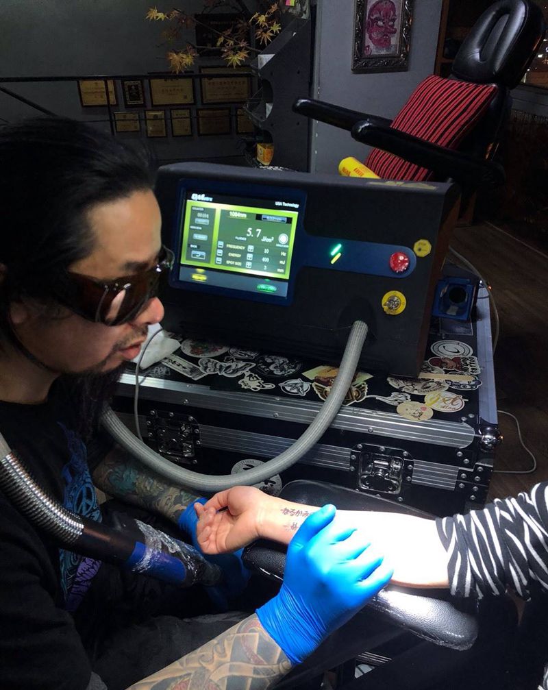 洗纹身纹身图片_洗激光皮秒纹身图案