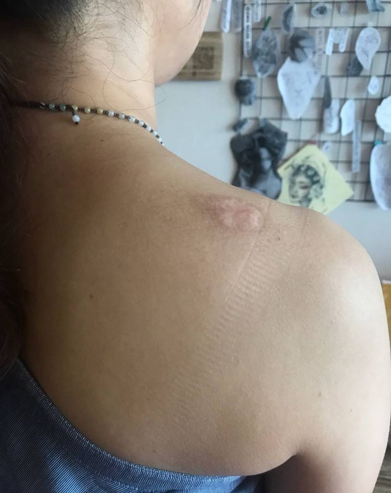 疤痕遮盖纹身图片