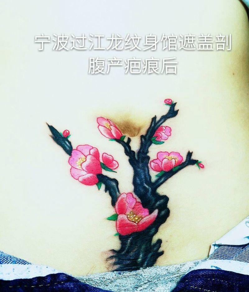 遮盖剖腹产疤痕纹身图片