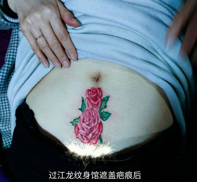 遮盖疤痕纹身图片