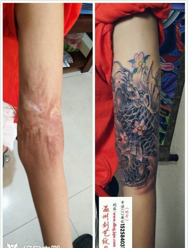 疤痕遮盖纹身图片