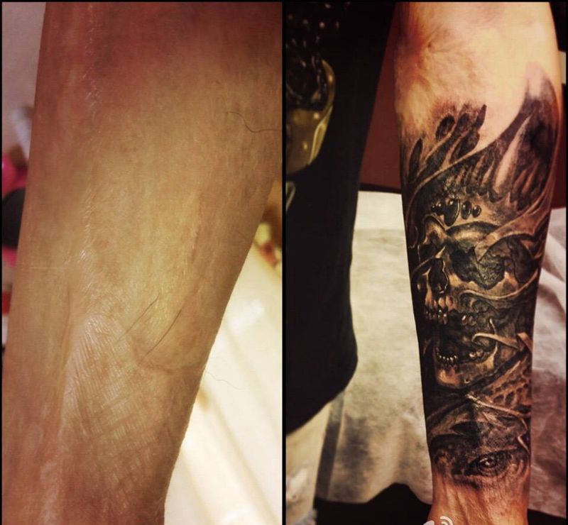 疤痕遮盖纹身图片