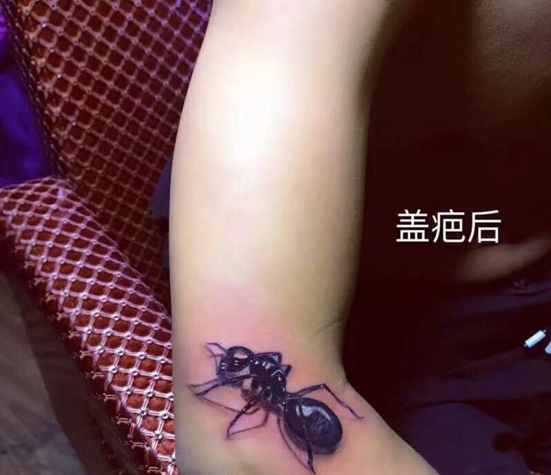 蚂蚁遮盖疤痕纹身图片