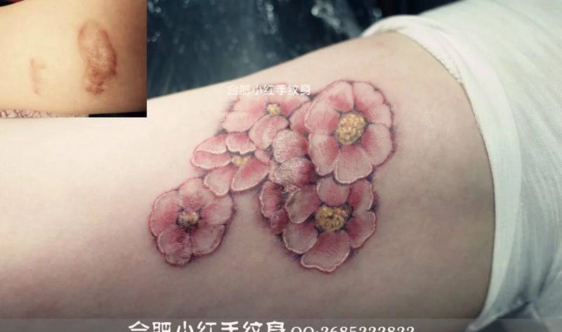 疤痕遮盖纹身图片