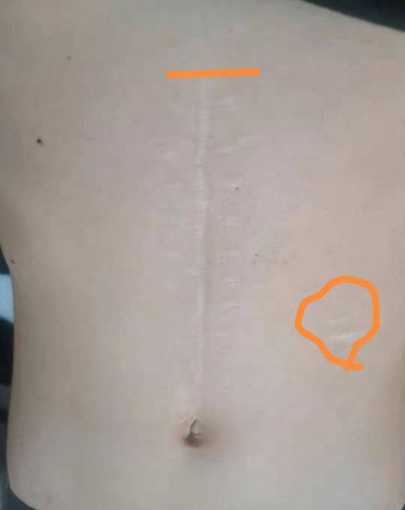 遮盖疤痕纹身图片_腹部纹身图案