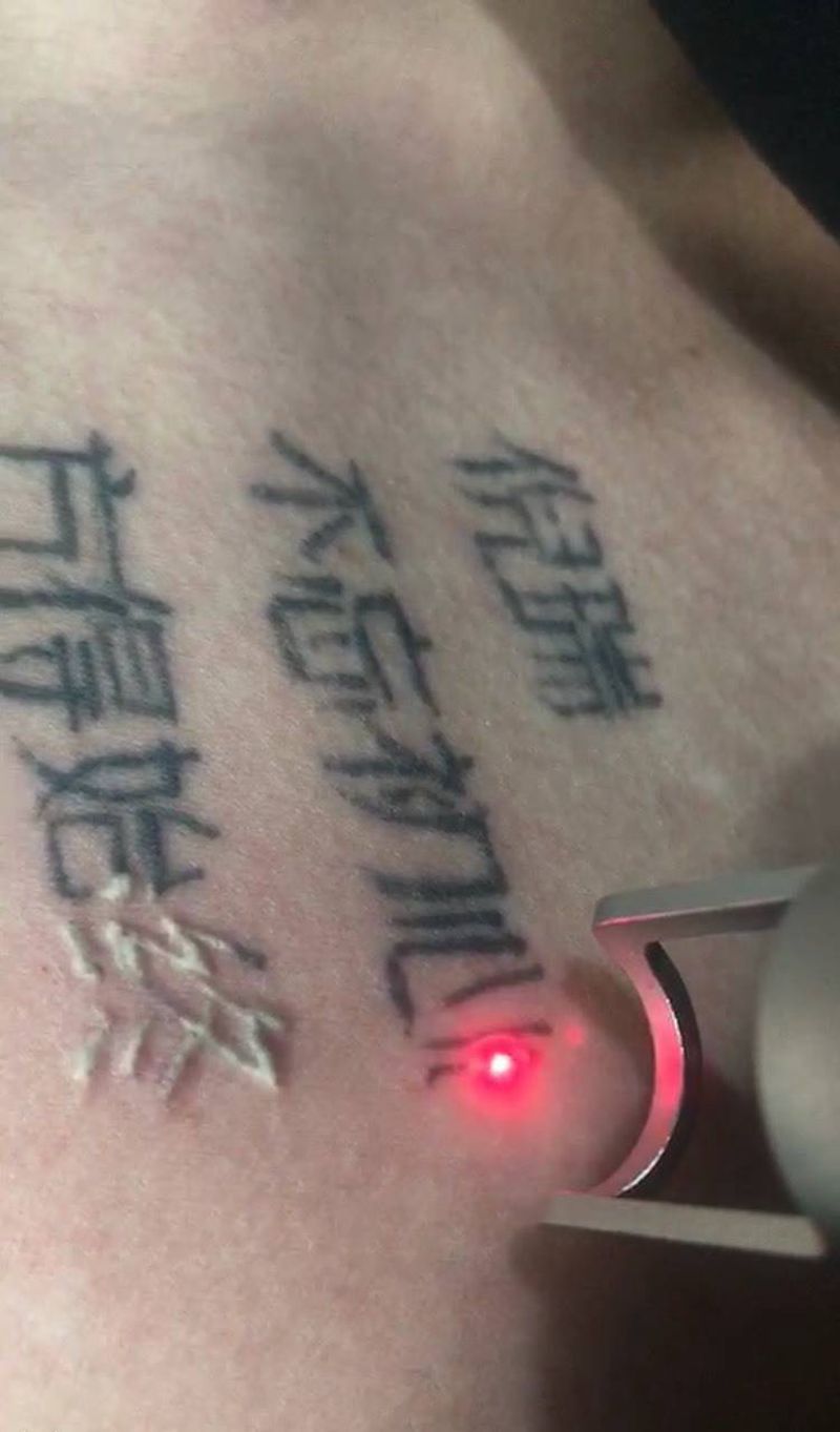 皮秒清洗纹身纹身图片