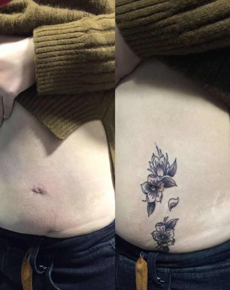 樱花遮盖腹部手术疤痕纹身图片