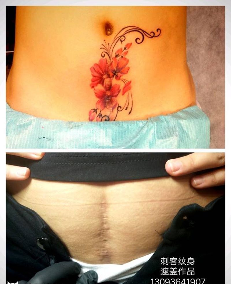 疤痕遮盖纹身图片_腹部写实植物成品纹身图案