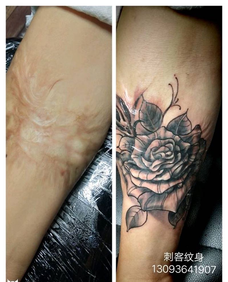 花，疤痕遮盖纹身图片_手臂手部欧美写实植物成品纹身图案