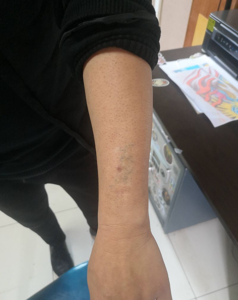 遮盖疤痕纹身图片_手臂纹身图案