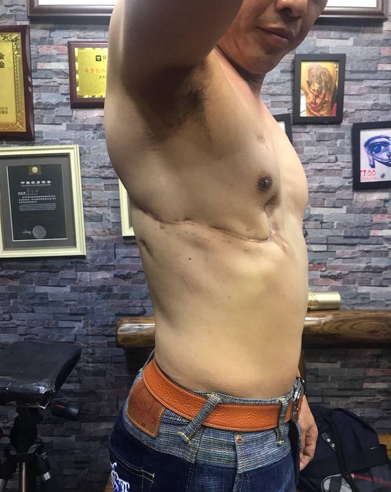 疤痕遮盖前后纹身图片