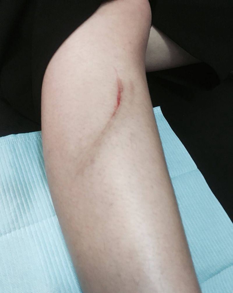 遮盖伤疤纹身图片