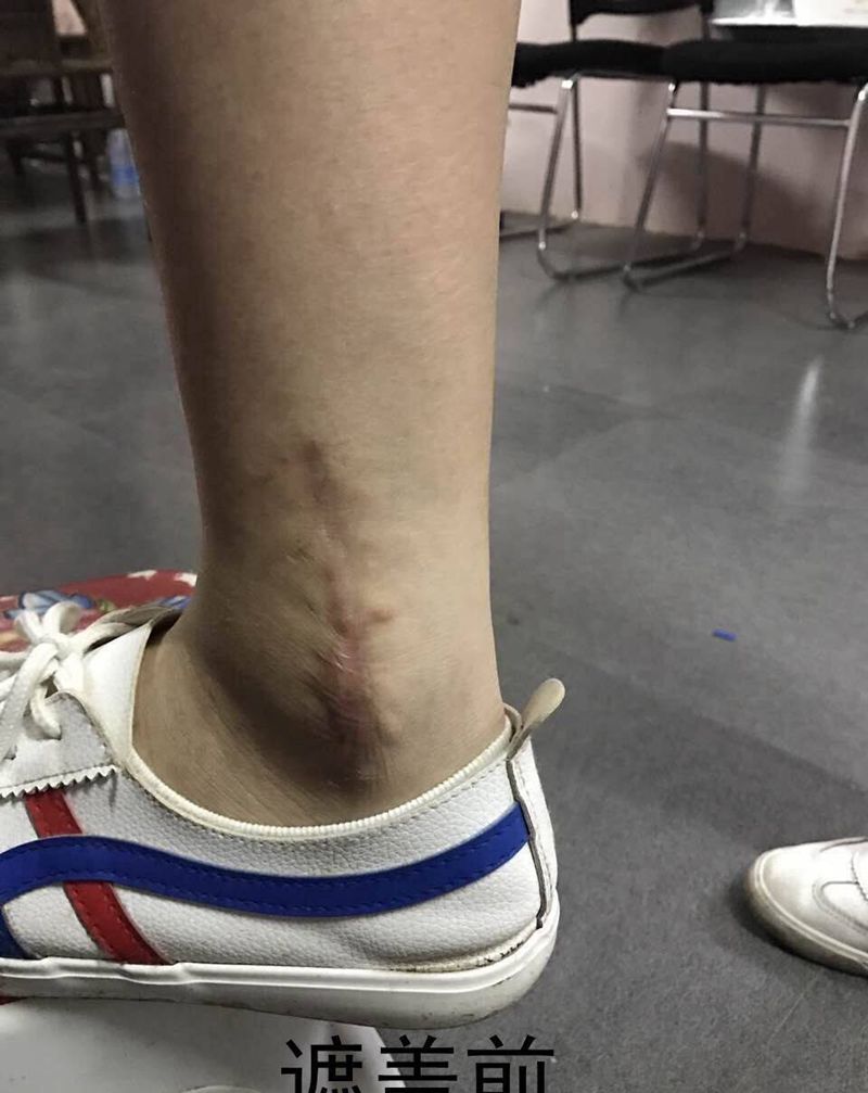 遮盖伤疤纹身图片