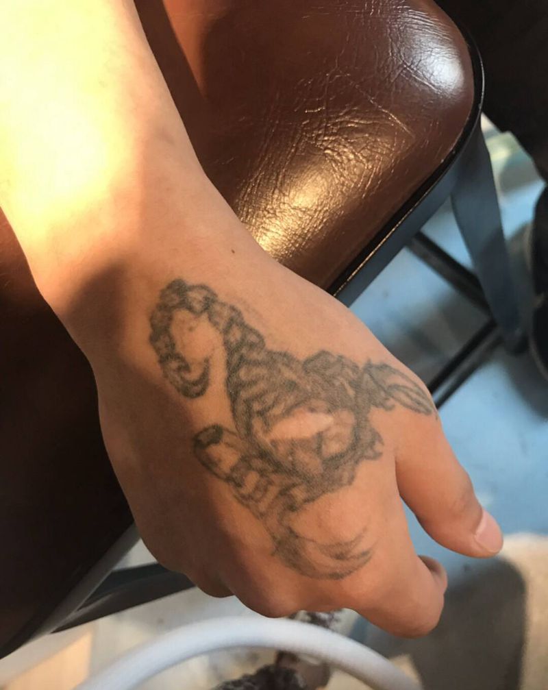 皮秒清洗即刻纹身图片_清洗纹身图案