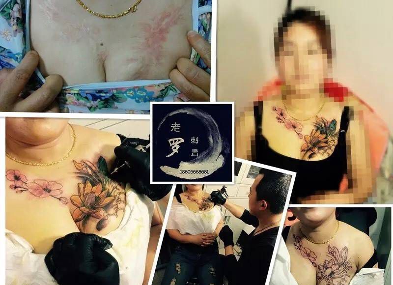烫伤遮盖纹身图片